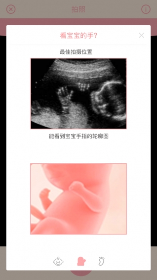 胎儿相机app