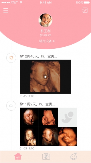 胎儿相机app