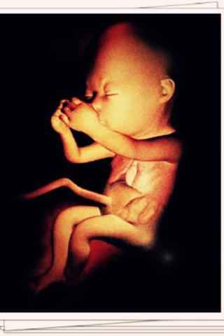 4D人体实拍胎儿发育全程